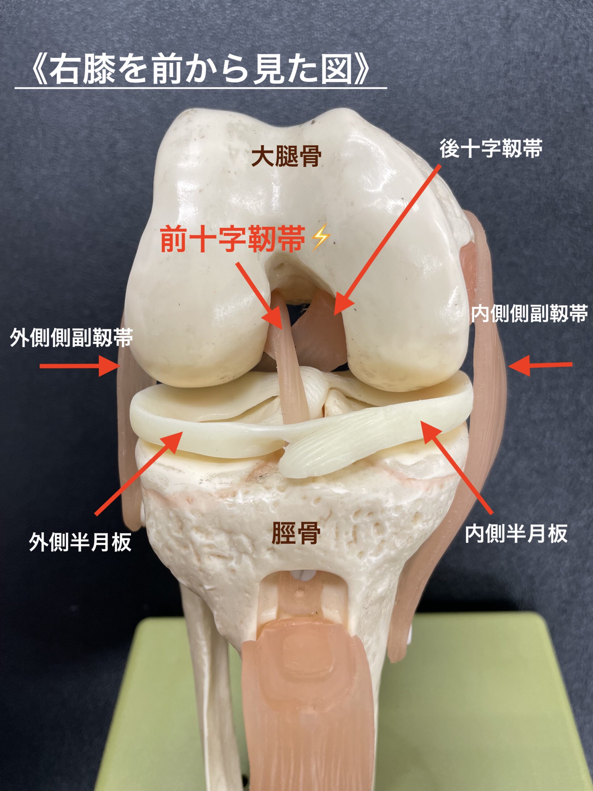 膝の重要な靭帯 前十字靭帯 カラダのくすり箱 R Body